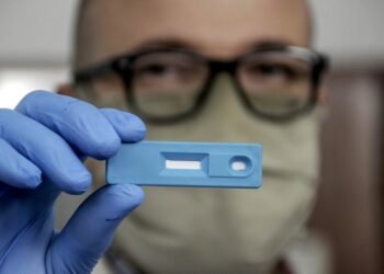 La Anmat autorizó el uso de cuatro test de autoevaluación de Covid-19